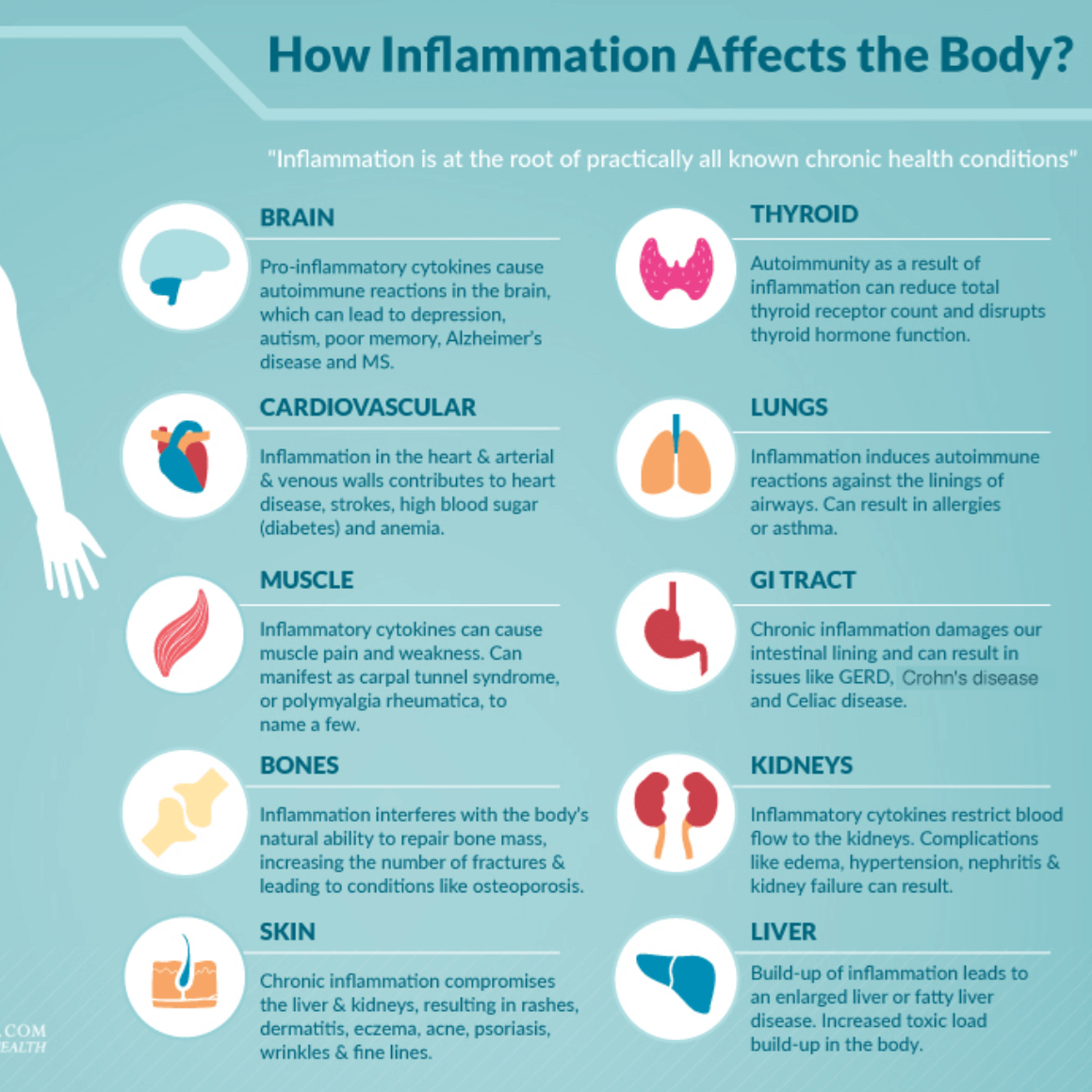 Inflammation